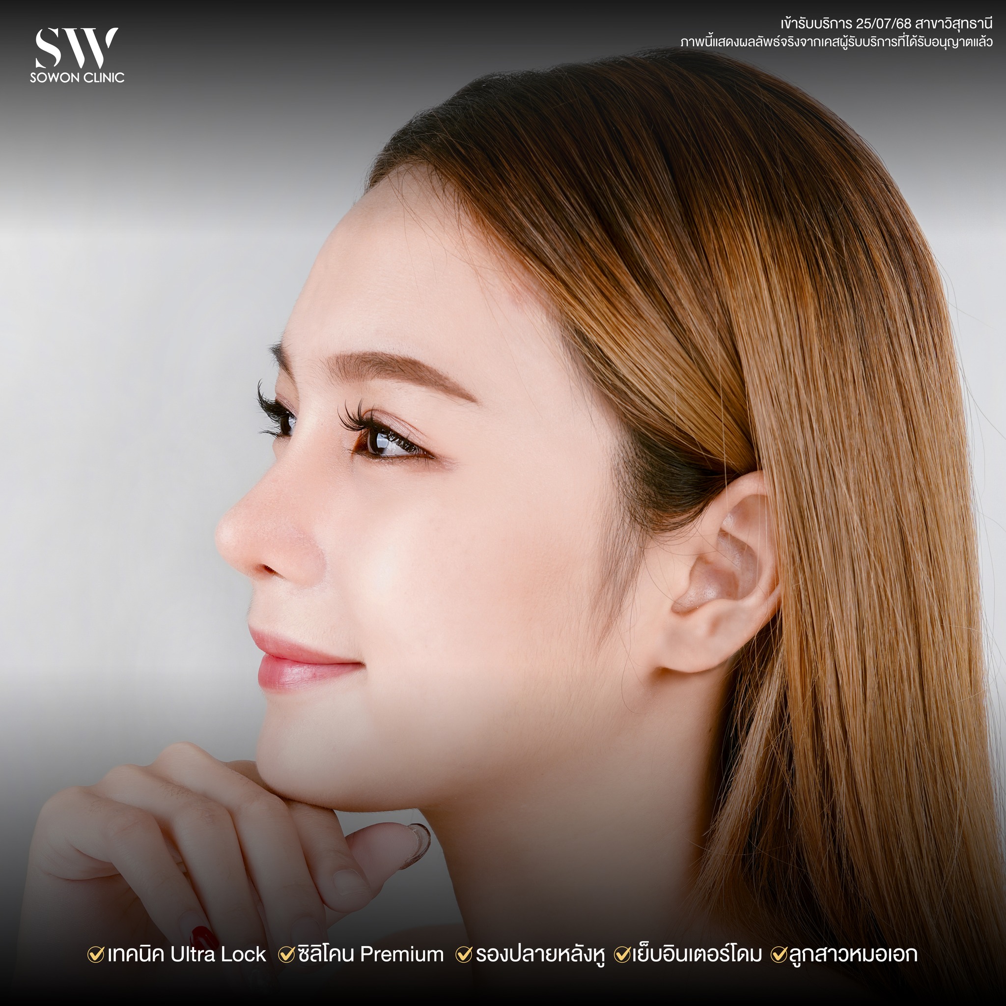 เสริมจมูกรีวิว 010