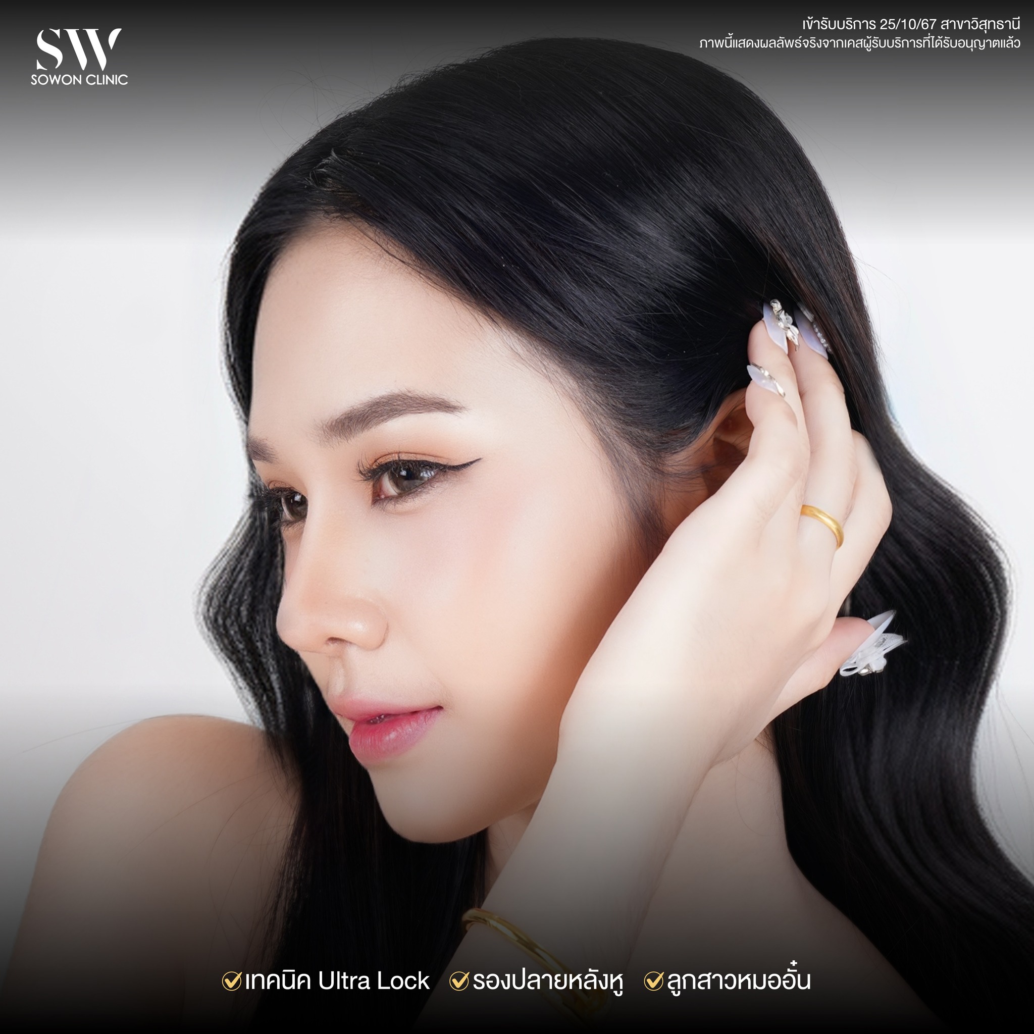 เสริมจมูกรีวิว 04