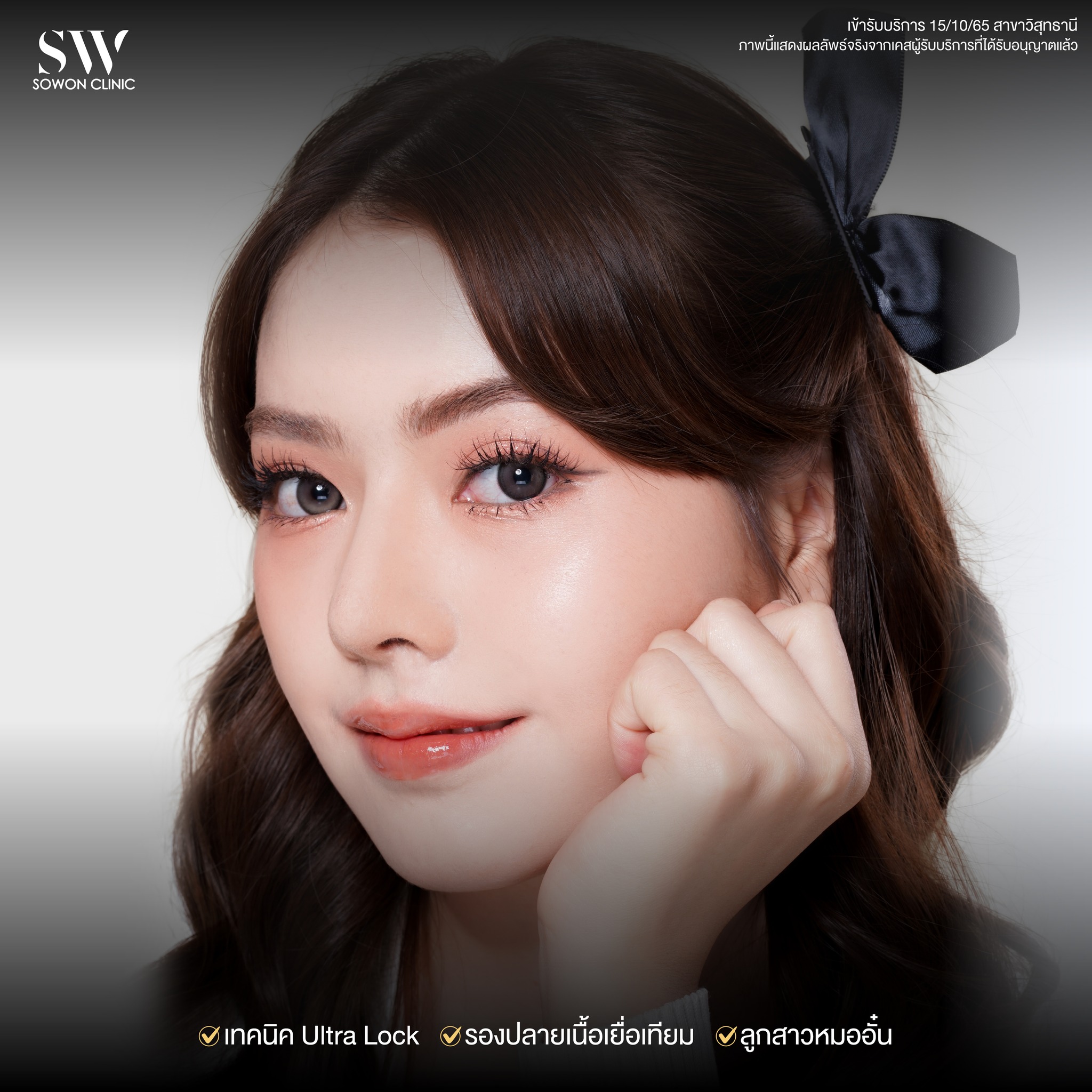 เสริมจมูกรีวิว 05