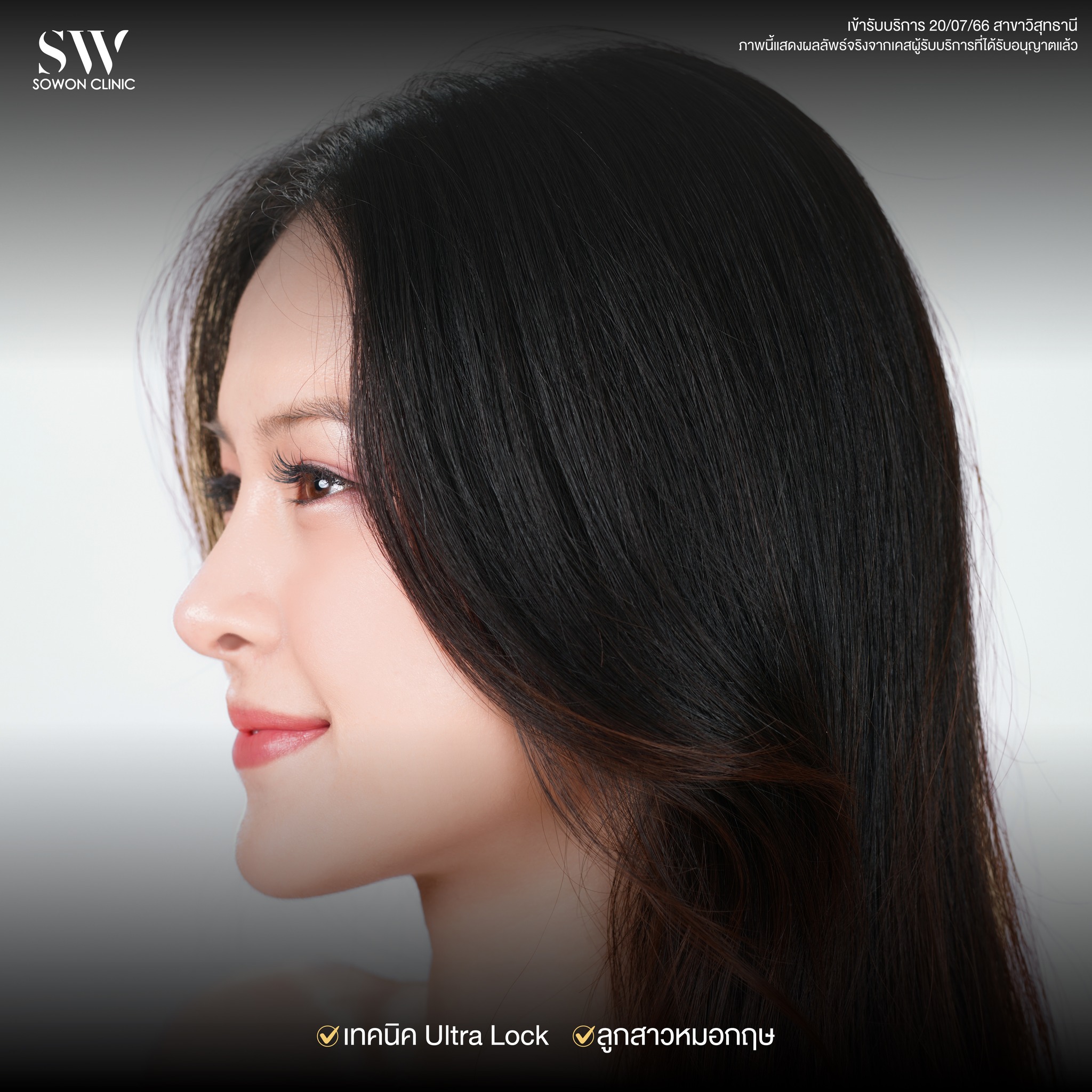 เสริมจมูกรีวิว 09