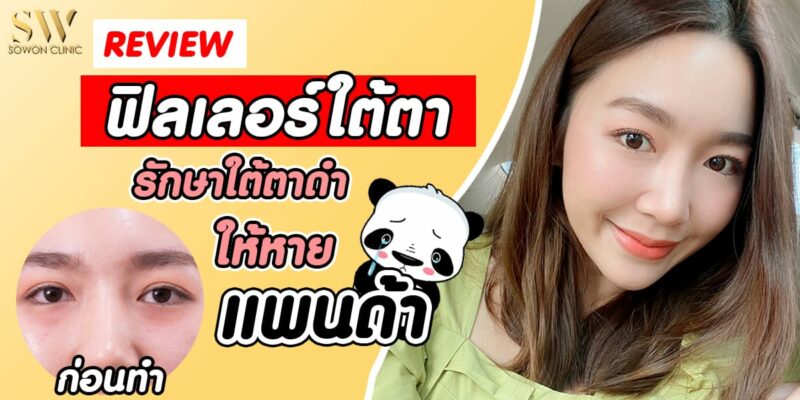 รีวิวฟิลเลอร์ใต้ตา รีวิวฟิลเลอร์ใต้ตา
