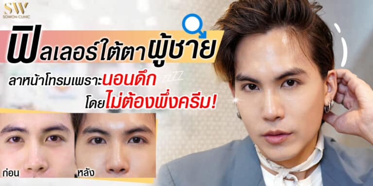 ฟิลเลอร์ใต้ตา