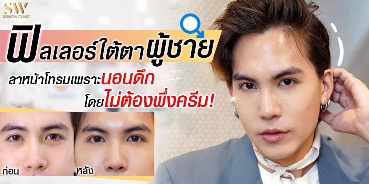 ฟิลเลอร์ใต้ตา ฟิลเลอร์ใต้ตา