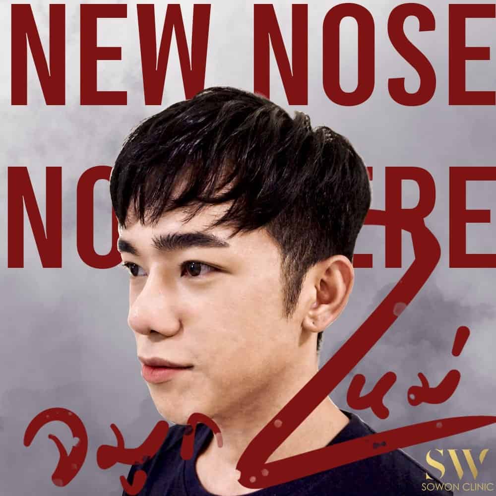 เสริมจมูกผู้ชาย