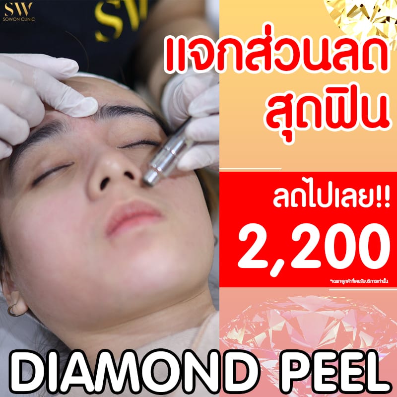 diamond peel