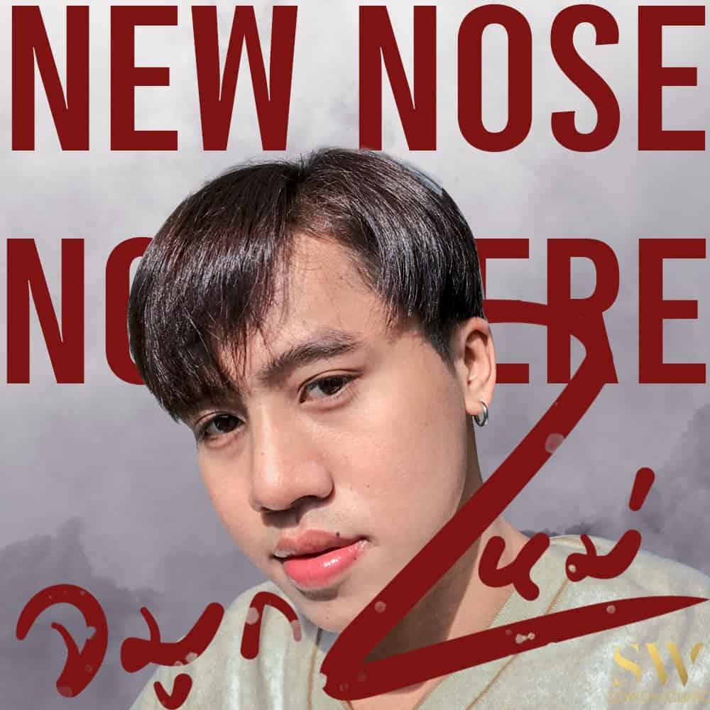 เสริมจมูกผู้ชาย