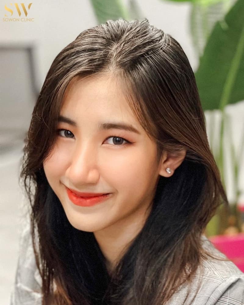 รีวิวฟิลเลอร์ใต้ตา