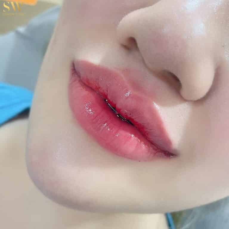 ทำปากที่ไหนดี 