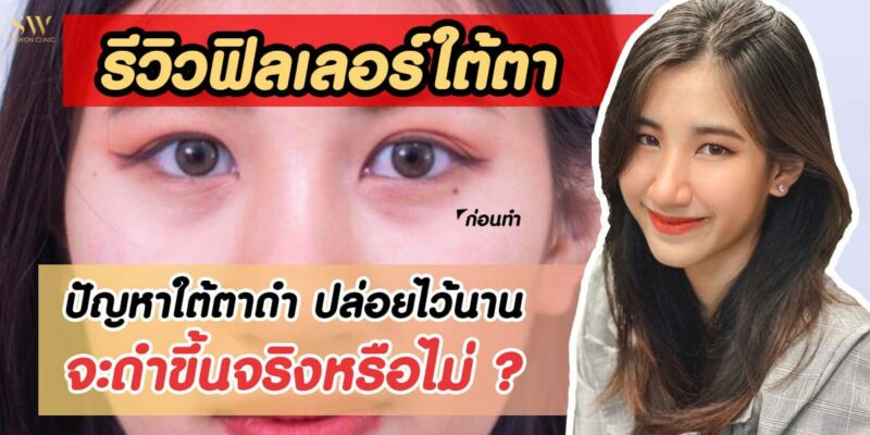 ปกบทความรีวิวใต้ตา