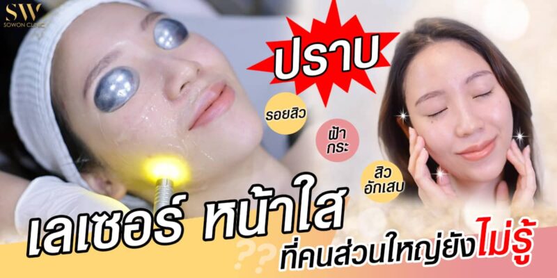 ปกบทความเลเซอร์หน้าใส ปกบทความเลเซอร์หน้าใส