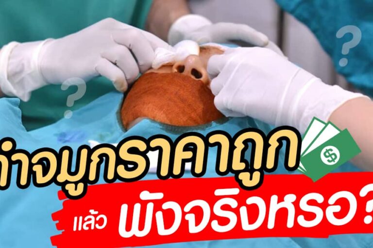 เสริมจมูก ราคา