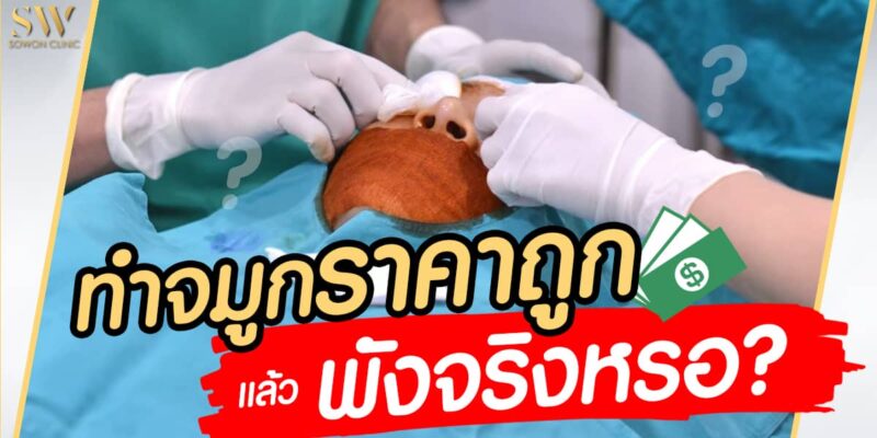 เสริมจมูก ราคา