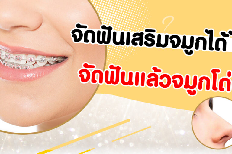 จัดฟันเสริมจมูกได้ไหม