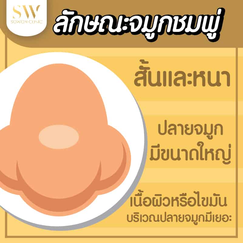 จมูกชมพู่Sowonclinic