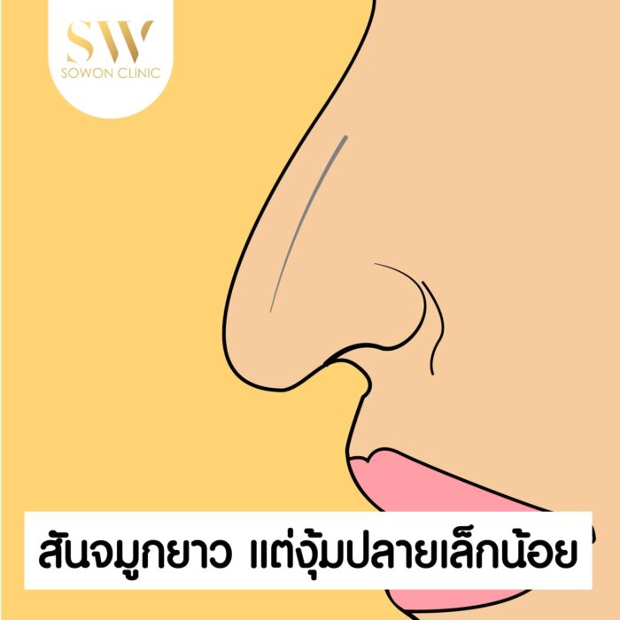 ทรงจมูก สันจมูกยาว ทรงจมูก สันจมูกยาว