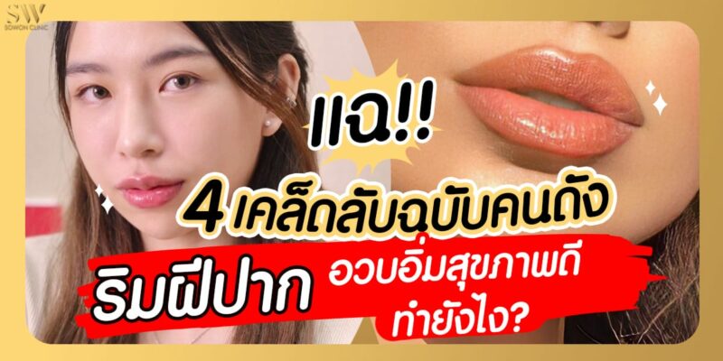 ฟิลเลอร์ปาก(1)