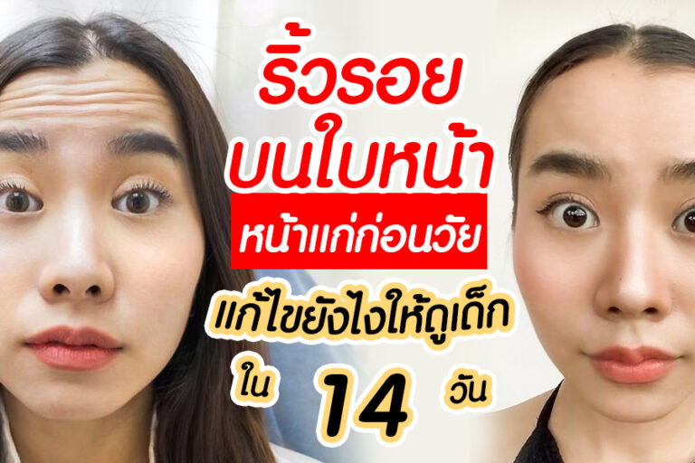 ริ้วรอยบนใบหน้า