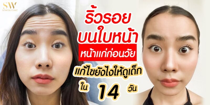 ริ้วรอยบนใบหน้า