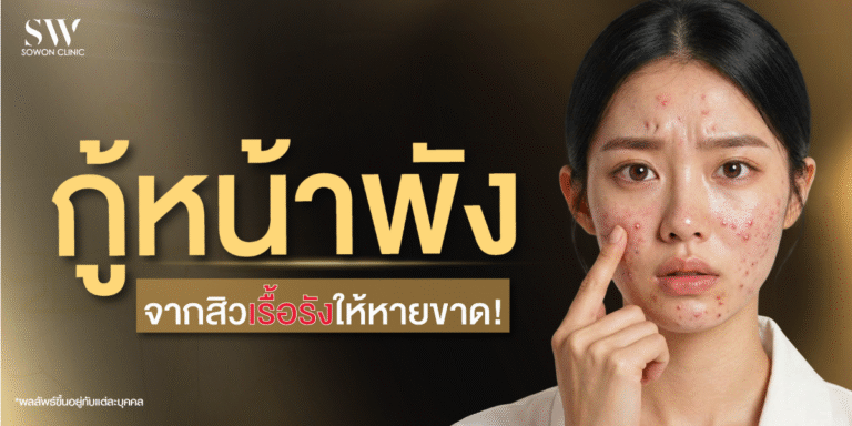 ปก yt กู้หน้าพัง