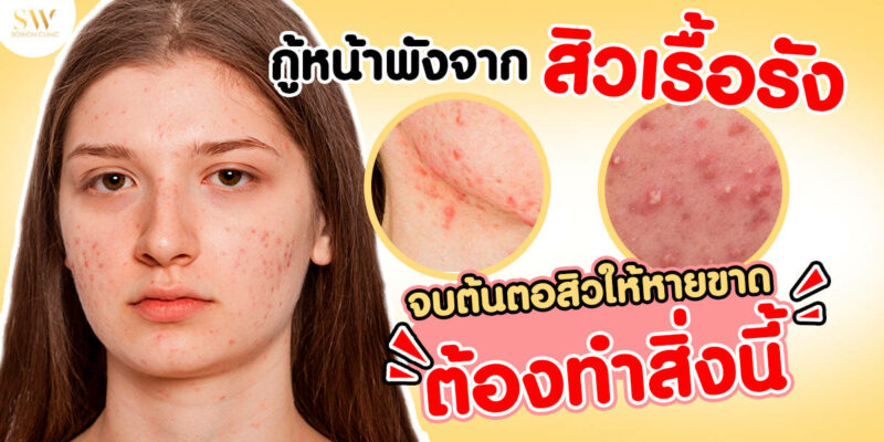 ปก yt กู้หน้าพัง