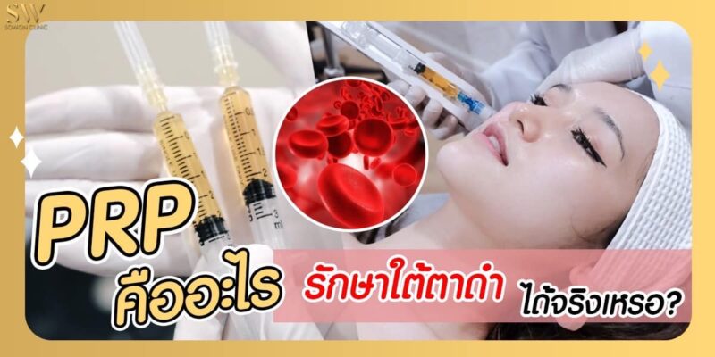 prp คืออะไร