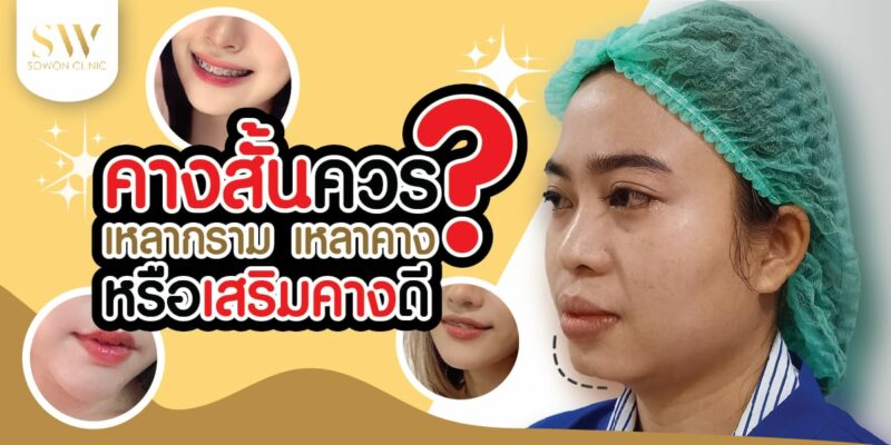 คางสั่น เหลากราม เหลาคาง เสริมคาง