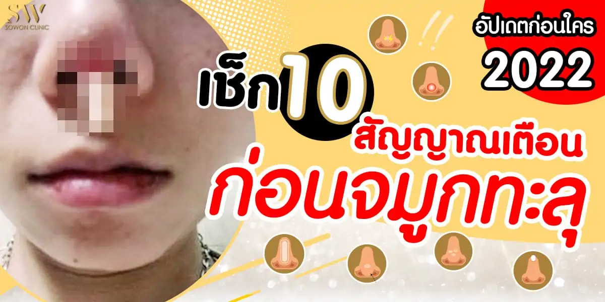 เสริมจมูก 10 สัญญาณเตือนสุดอันตราย เช็กตัวเองให้ทันก่อนจมูกทะลุ