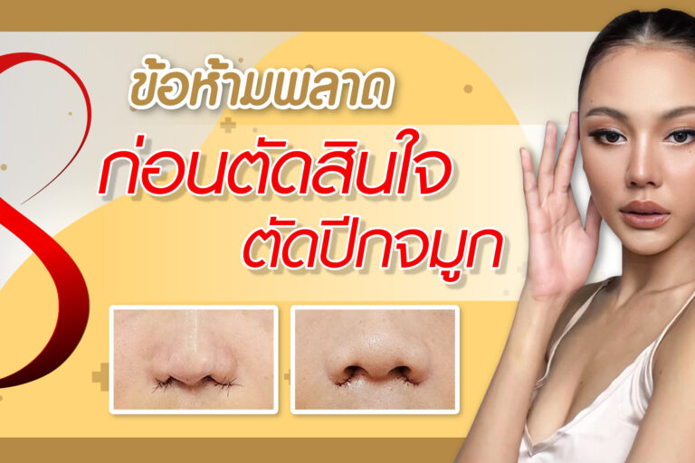 การศัลยกรรมตัดปีกจมูก