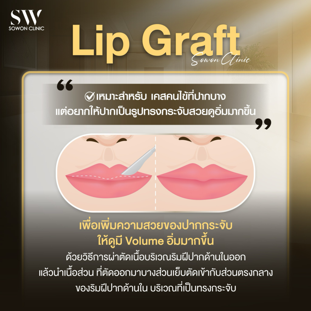 LIP GRAFT คืออะไร ทำแล้วสวยไหม?