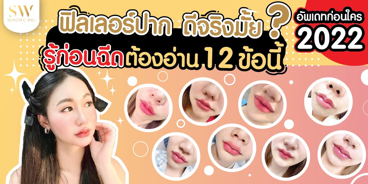 ฟิลเลอร์ปาก ดีจริงมั้ย-01