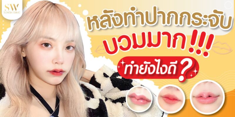 ปากกระจับ