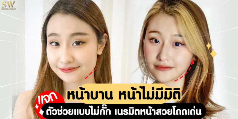 botoxโบวี่