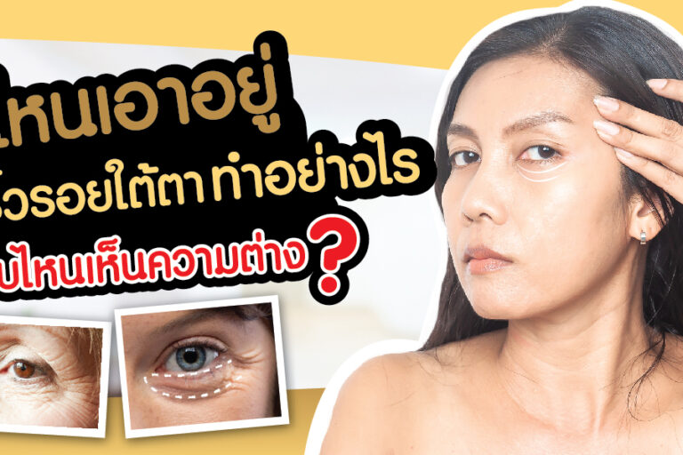 ริ้วรอยใจใต้ตา