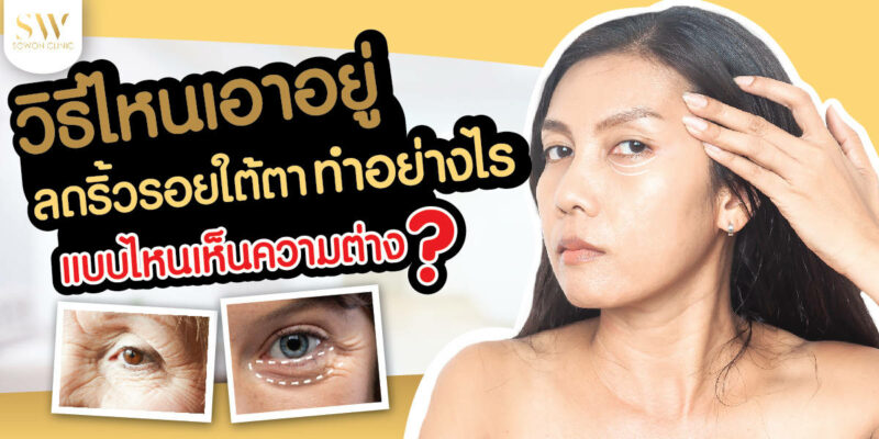 ริ้วรอยใจใต้ตา