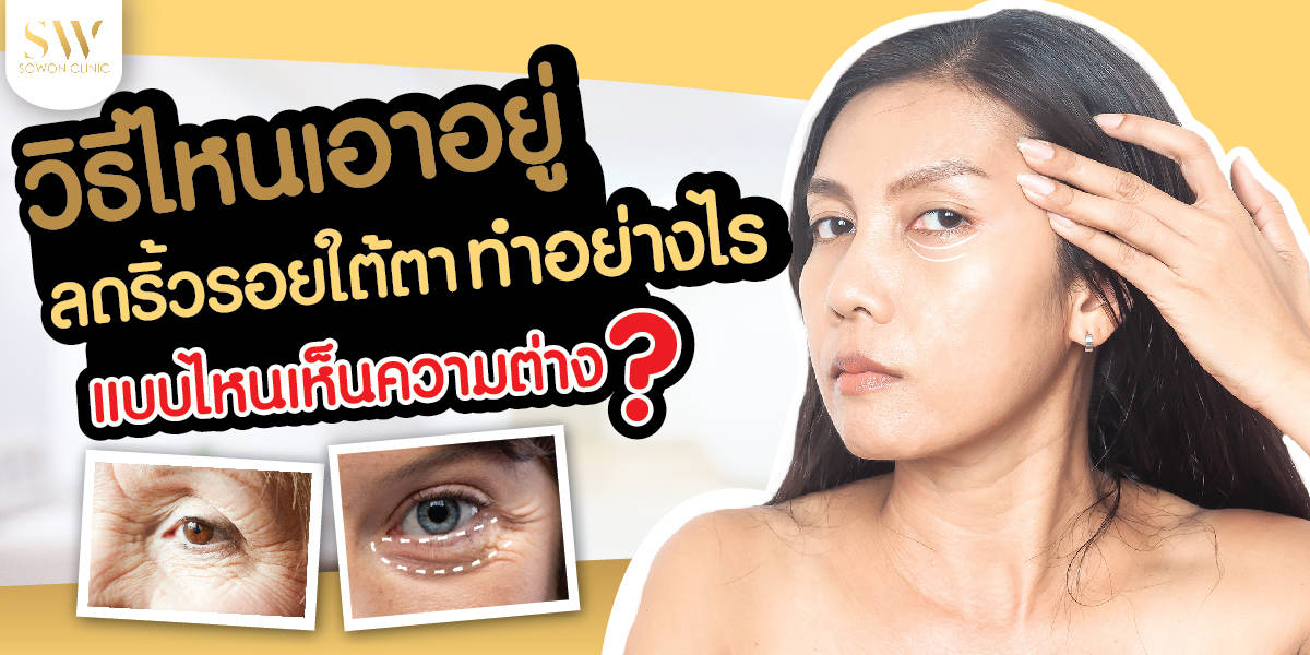 วิธีไหนเอาอยู่ ลดริ้วรอยใต้ตา-01 ริ้วรอยใจใต้ตา