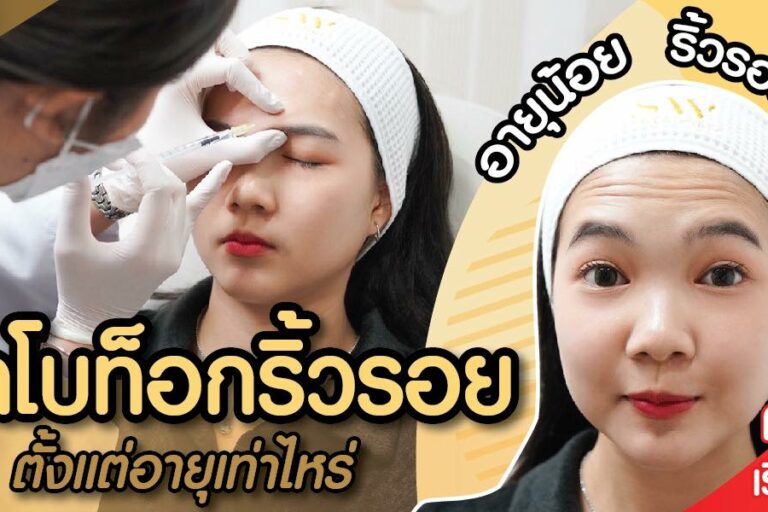 ปกบทความโบท็อกริ้วรอย