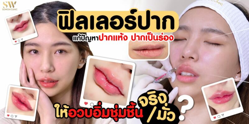 ฟิลเลอร์ปากอวบอิ่ม