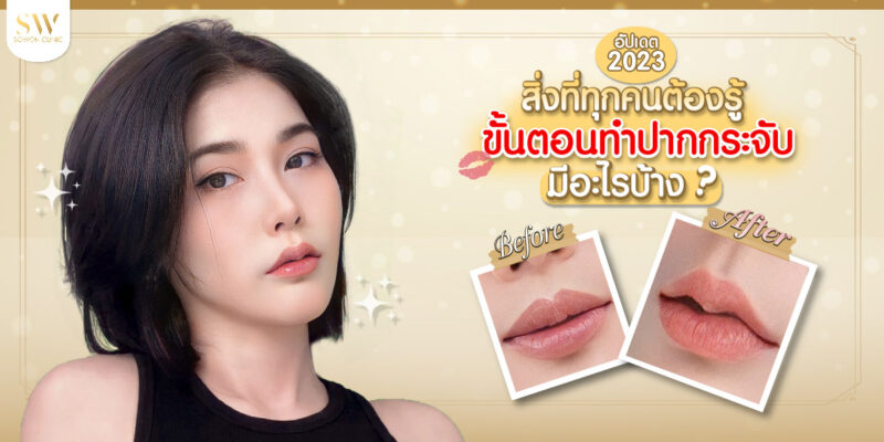 สิ่งที่ต้องปากกระจับ 2023 ทำปากกระจับ