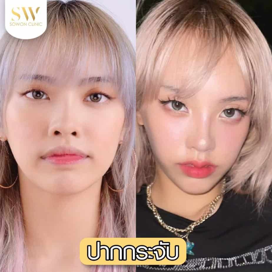 ปากกระจับ