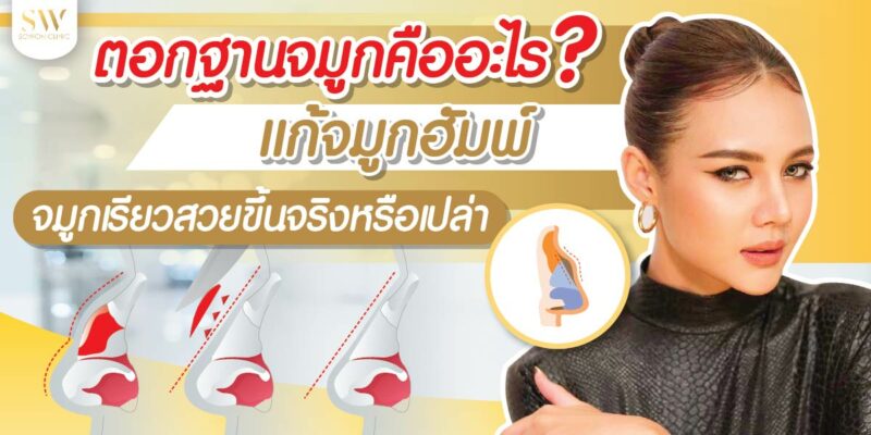 ตอกฐานจมูก