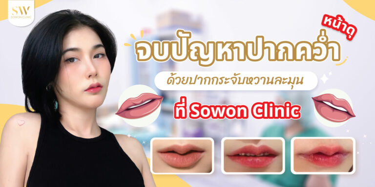 จบปัญหาปากคว่ำ ด้วยปากกระจับ