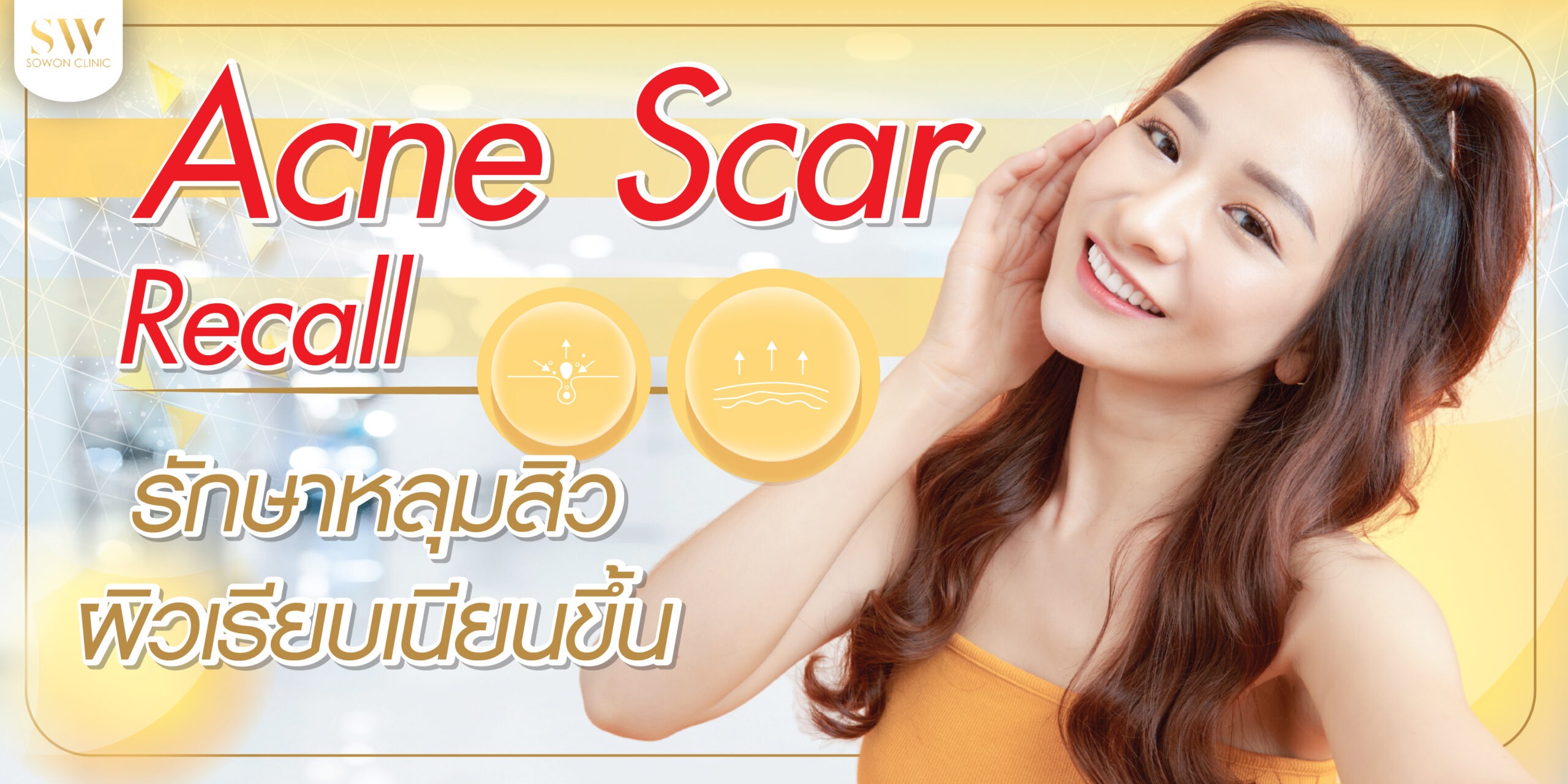 Acne scar recall