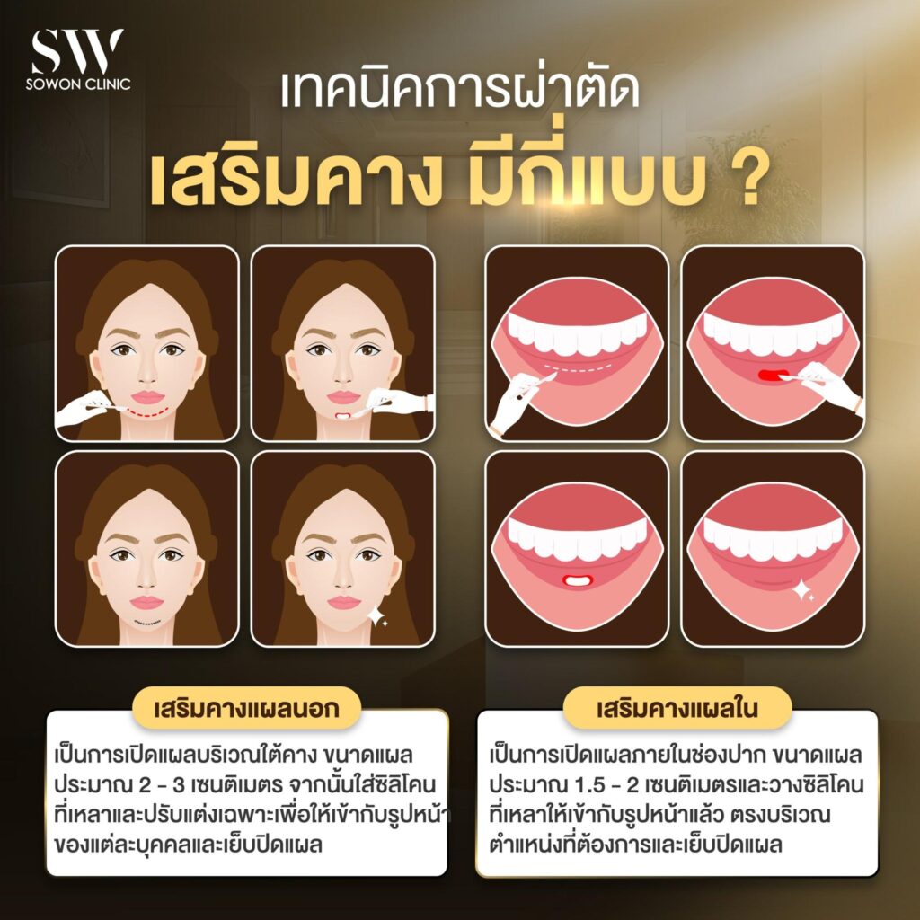 Chin sergery bangkok