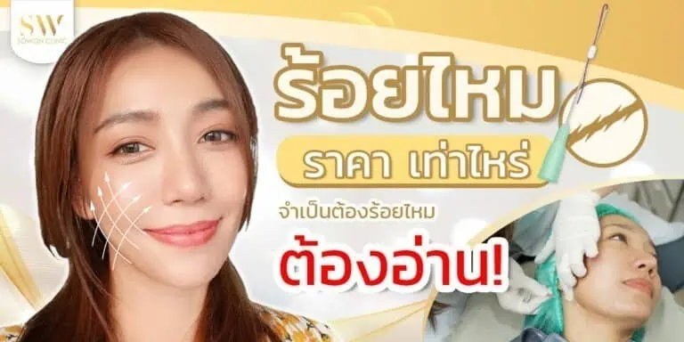 ร้อบไหม ราคา