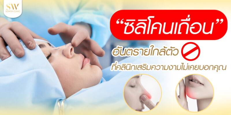 ซิลิโคนเถื่อน