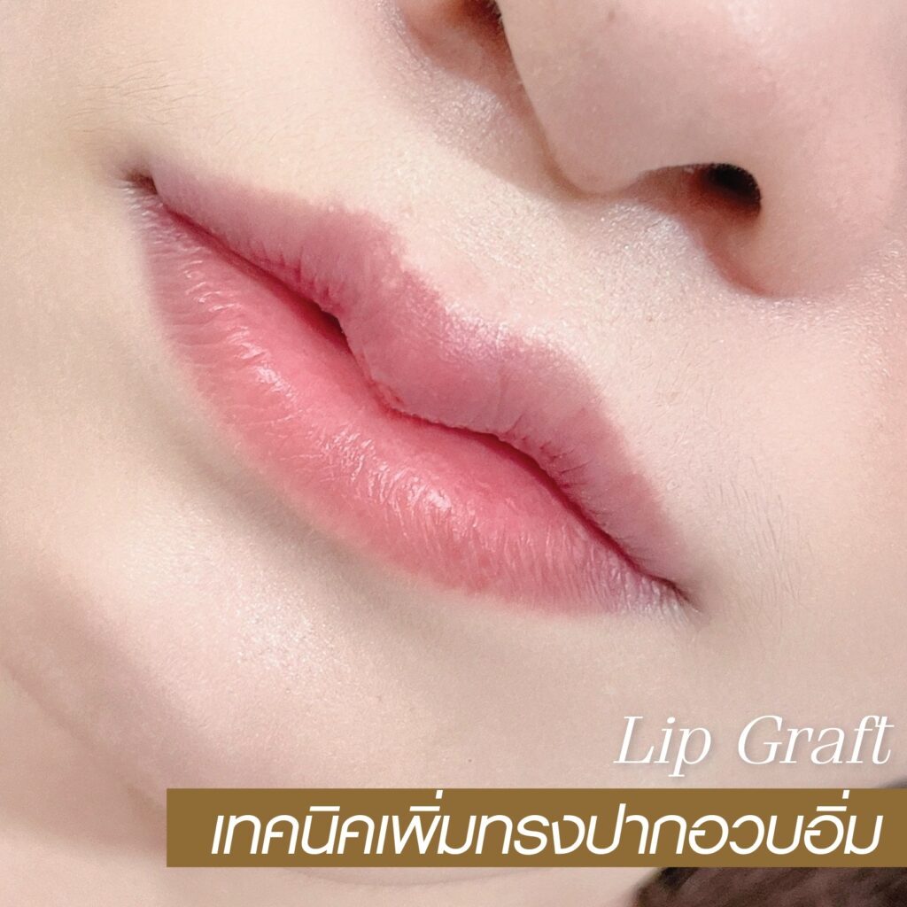 Lip Graft โซวอน