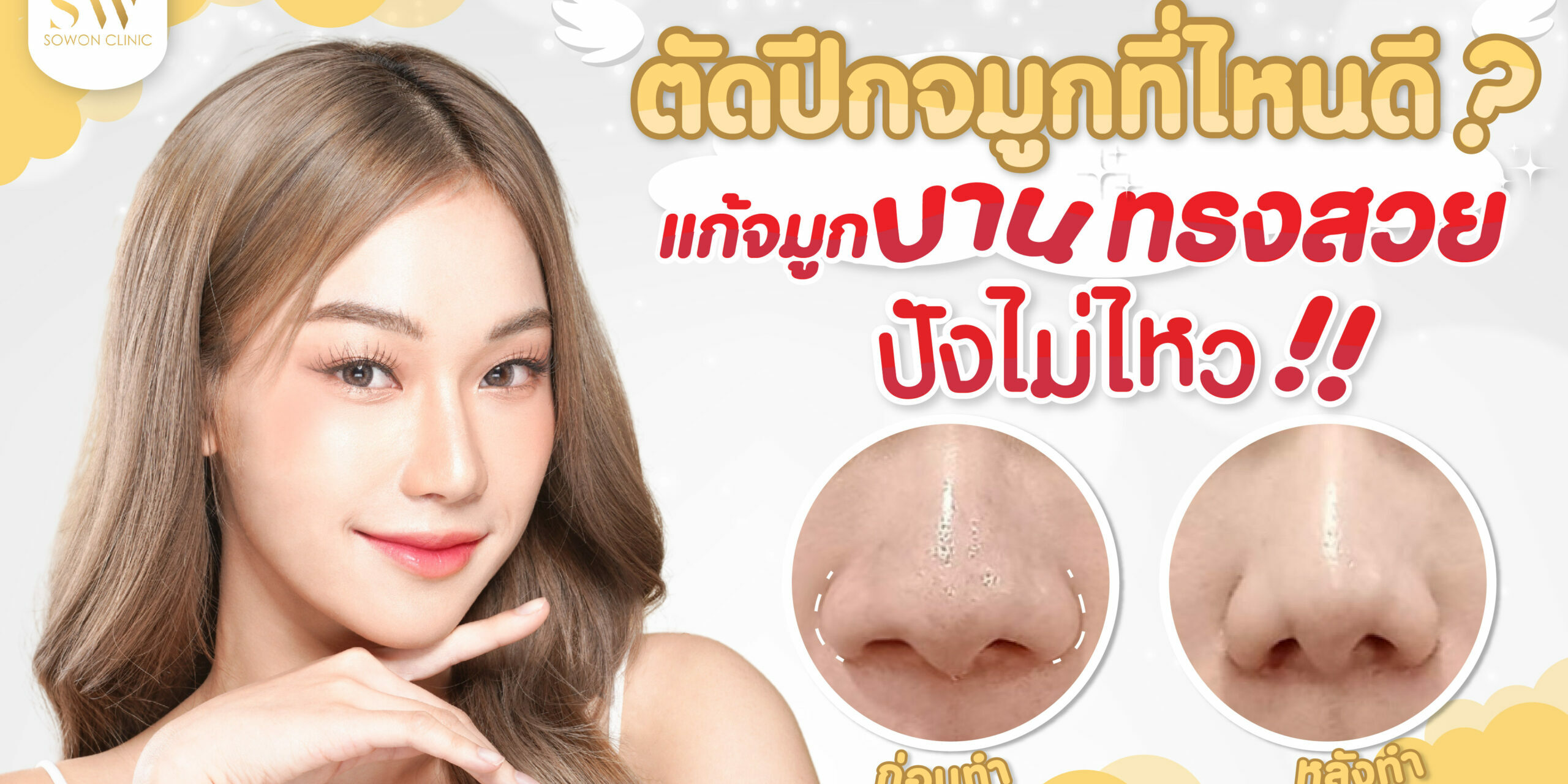 ปกบทความตัดปีกจมุก ปกบทความจัดปีกจมุก