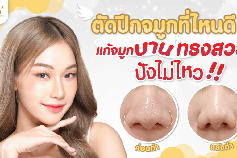 ปกบทความจัดปีกจมุก