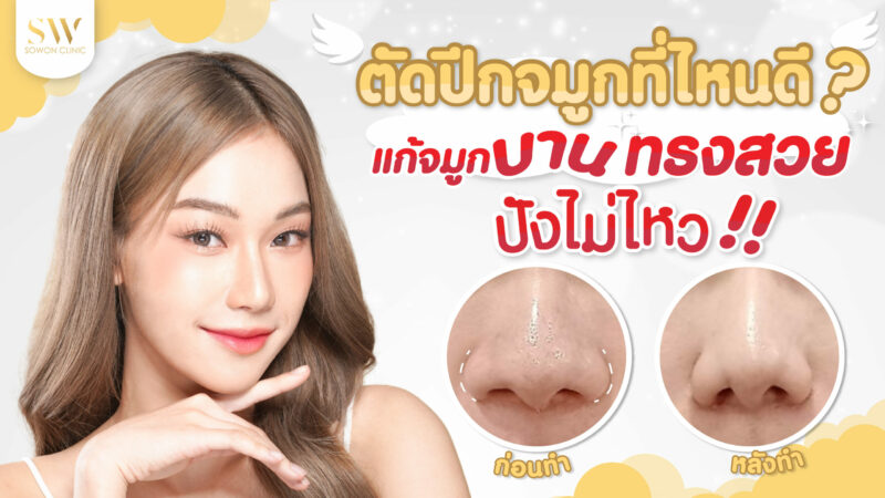 ปกบทความจัดปีกจมุก