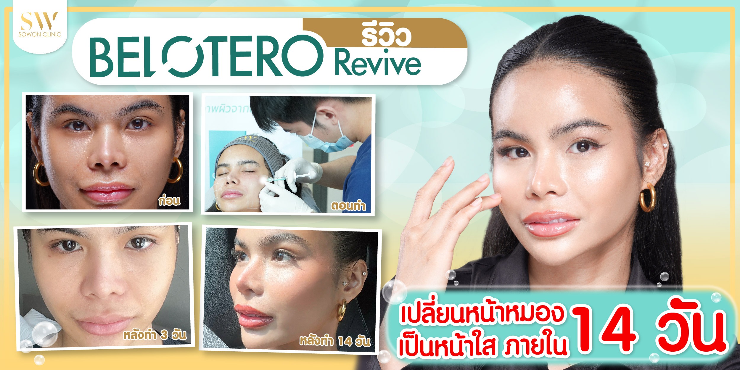belotero revive รีวิว